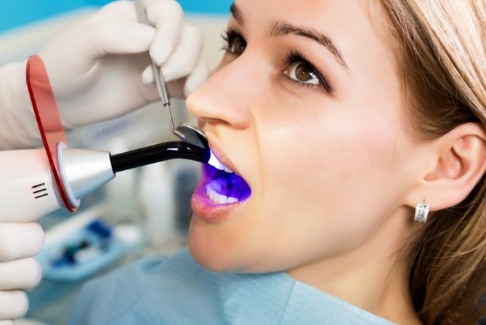 Dental patient receiving cosmetic bonding on her front tooth